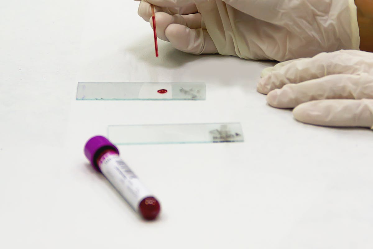 Anemia